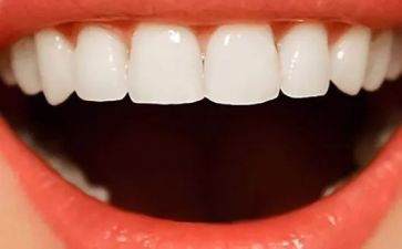 爱牙日活动宣传活动总结范文5篇